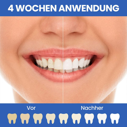 Oclean Flow Elektrische Zahnbürste, Schallzahnbürste mit 180 Tage Akkulaufzeit, 5 Putzmodi Zahnbürste Elektrisch IPX7 Sonic Electric Toothbrush mit DuPont Zahnbürstenkopf, Timer (Blau)